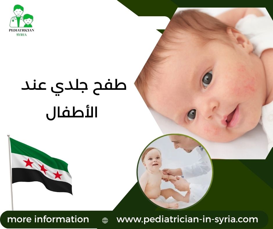 طفح جلدي عند الأطفال