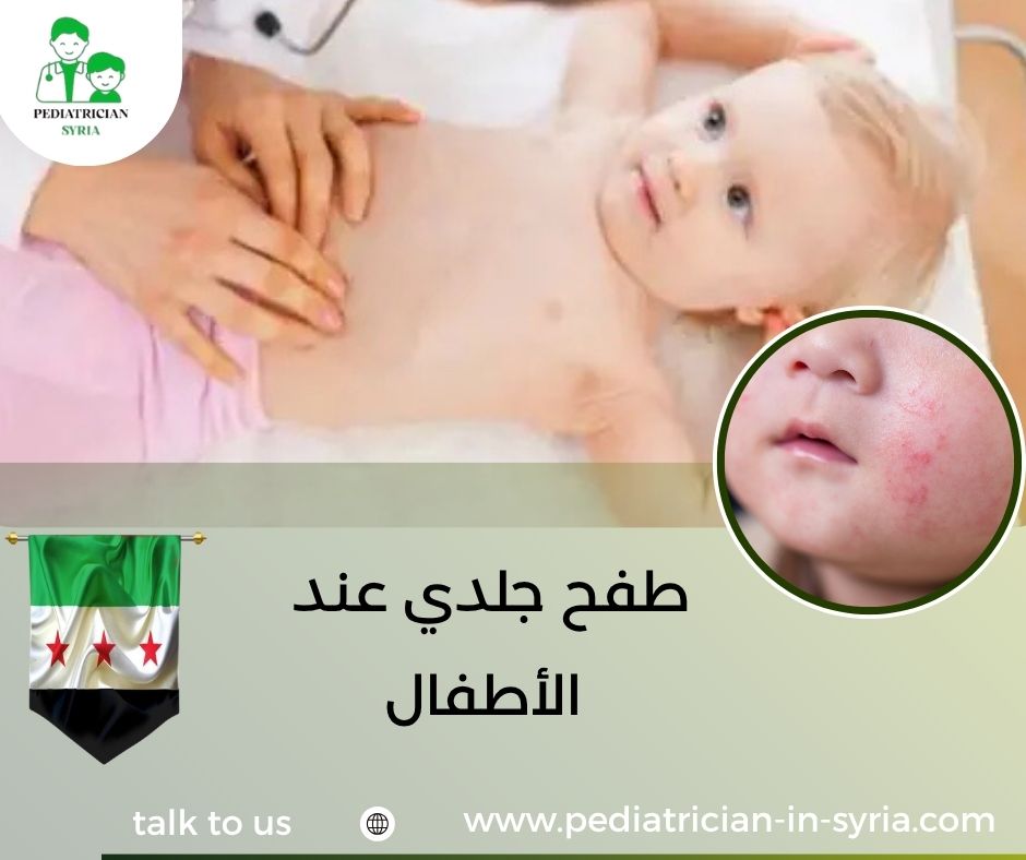 طفح جلدي عند الأطفال