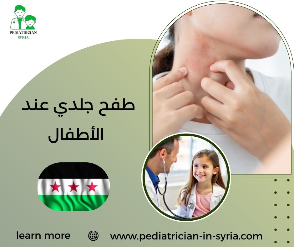 طفح جلدي عند الأطفال