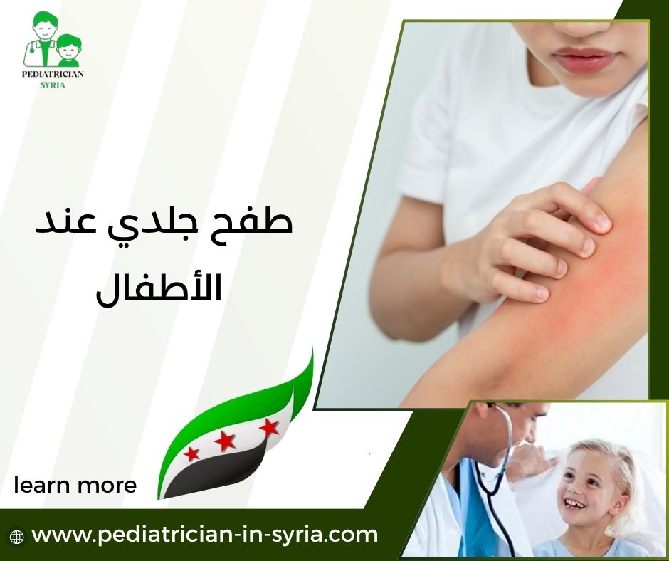 طفح جلدي عند الأطفال